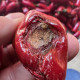 Anthracnose
